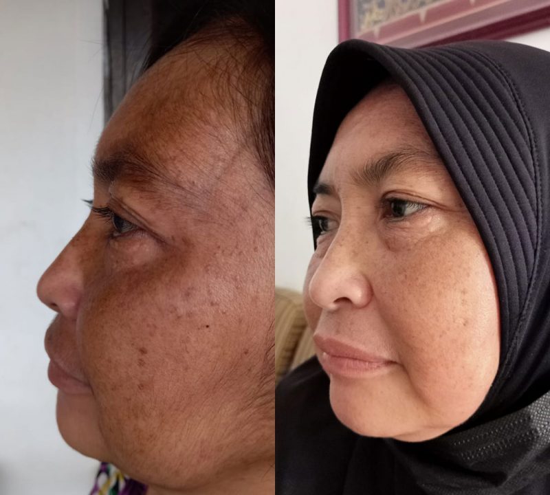 Sebelum Penggunaan